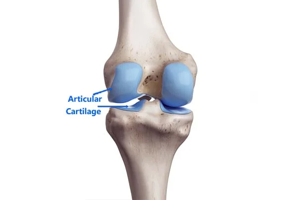Cartilage Injury