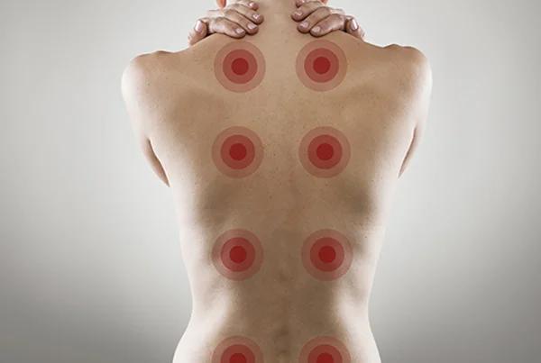 Fibromyalgia