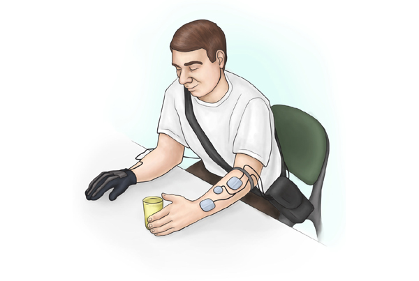 Functional Electrical Stimulation