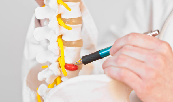 Degenerative Disc Disease