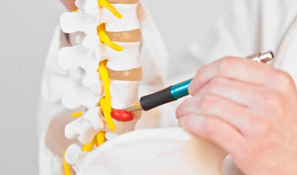 Degenerative Disc Disease