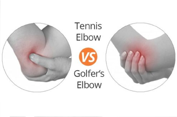 Tennis and Golfers Elbow