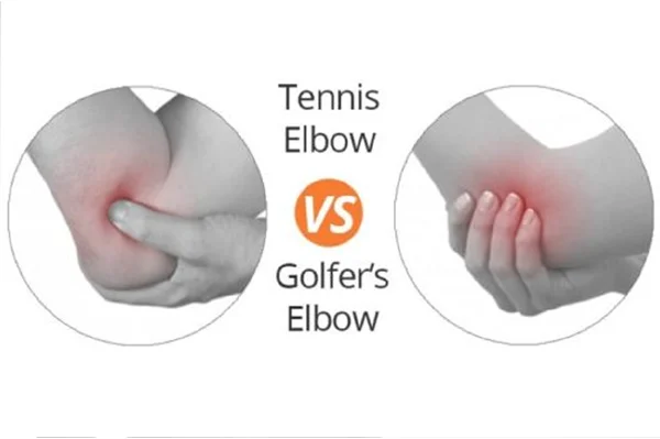 Tennis and Golfers Elbow