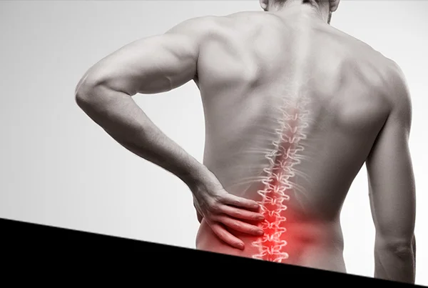 Low Back Pain