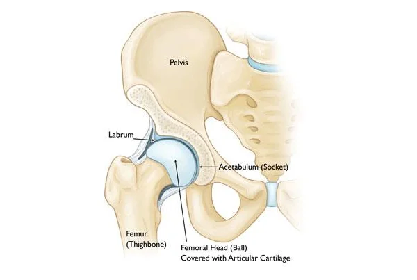 Hip Dislocation