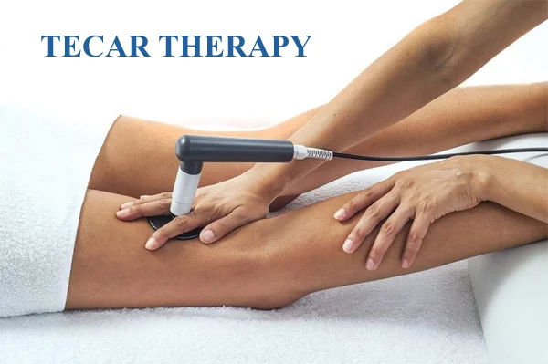 TECAR Therapy